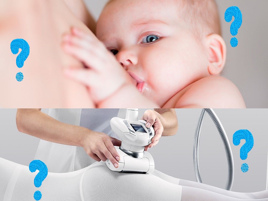 LPG-массаж при лактации